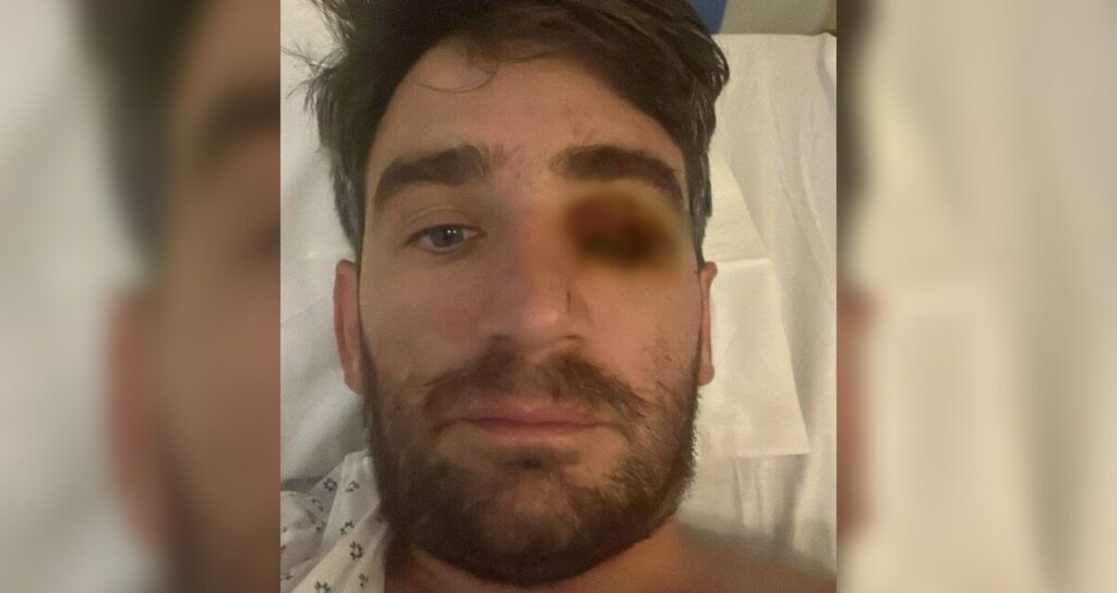 Accidente en Sacramento: Hombre pierde un ojo tras explosión de fuegos pirotécnicos en fiesta de Año Nuevo